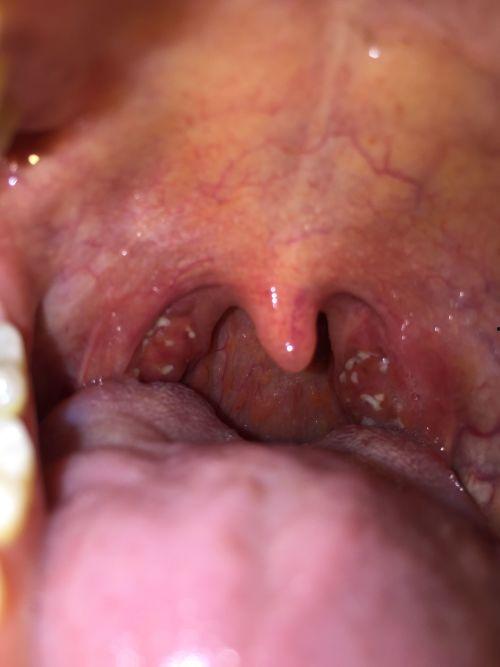 吃小白瓜喉咙疼,揭秘食用禁忌与应对策略